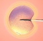 icsi[1]